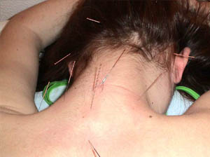 Detalle de la parte posterior del cuello de una paciente