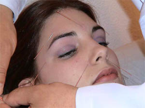 Rostro de una paciente