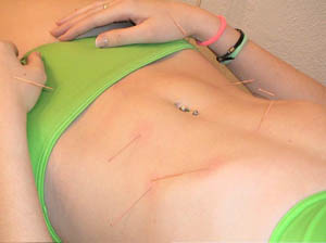 Imagen del abdomen de una paciente sobre una camilla